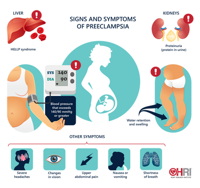 Preeclampsia: signs symptoms and treatment • Heart Research Institute