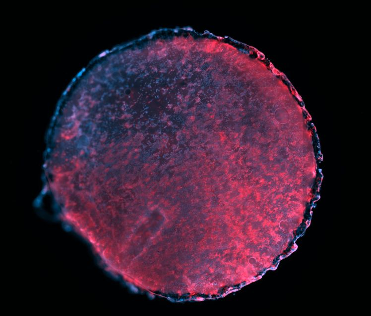 Stem-cell-patch-Richard-Tan-3000