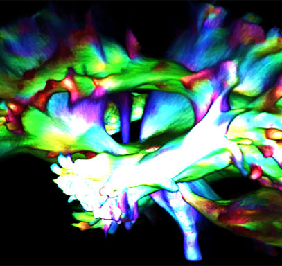 Cardiac-Imaging-banner